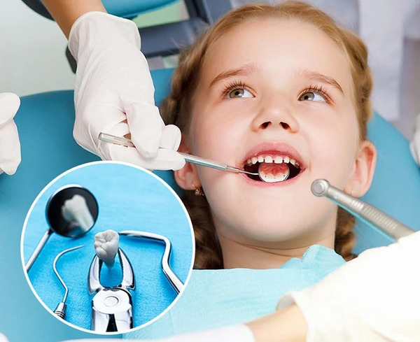 Baby tooth extraction