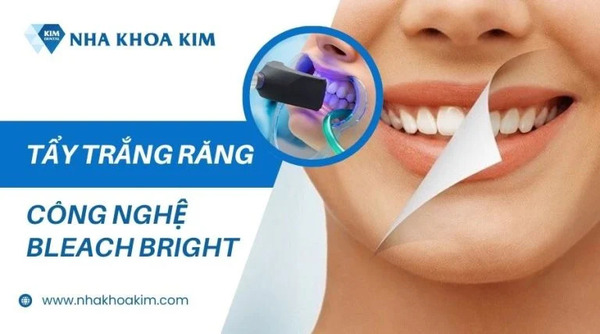 Teeth whitening