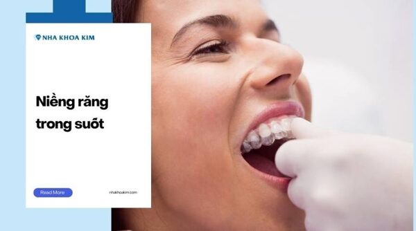 Clear aligners