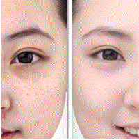 Whitening oral capsule