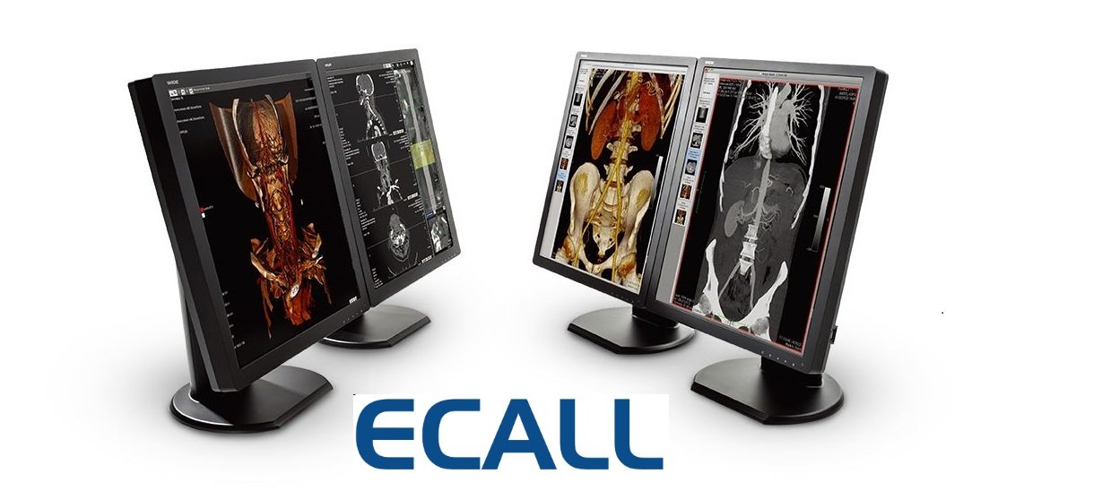 Surgical screen