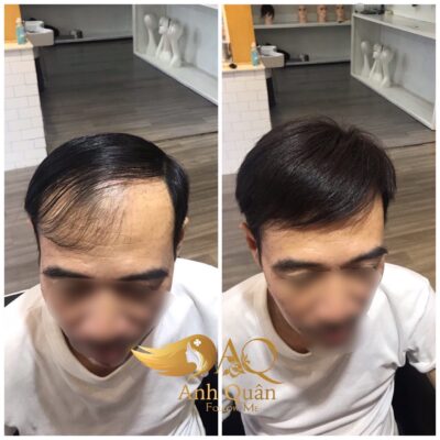 Men wig