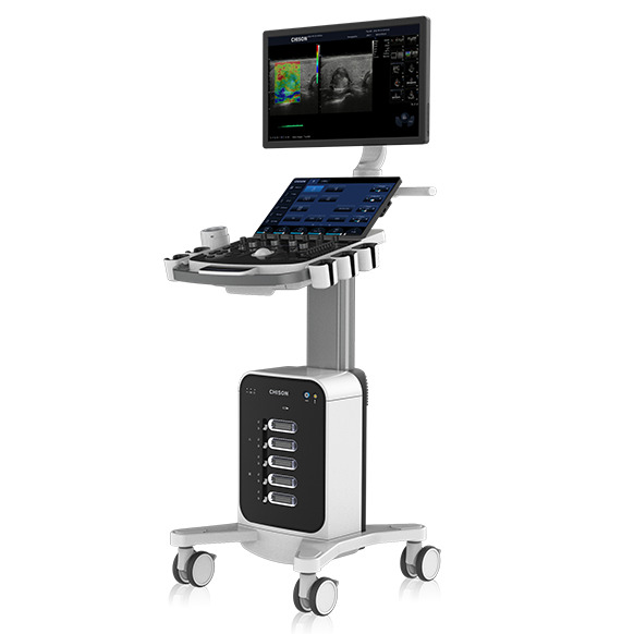 Cart-based ultrasound